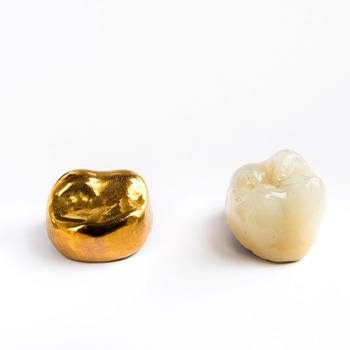 Dental crowns made of different materials