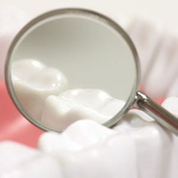 Closeup of teeth with dental sealants