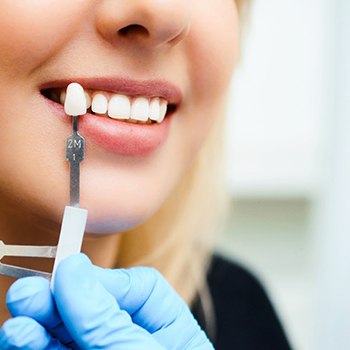 a patient undergoing the veneers process in Dallas