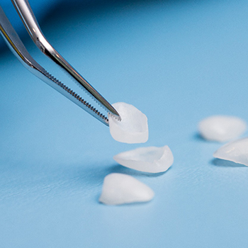 A dentist holding veneers in Dallas