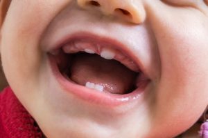 Up-close view of front baby teeth