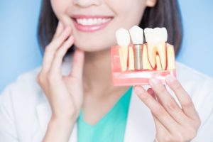 dentist holding a model of dental implants in Oak Cliff 