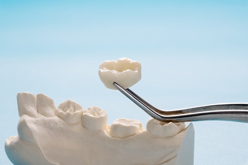 A close-up of a single dental crown held by a tweezer